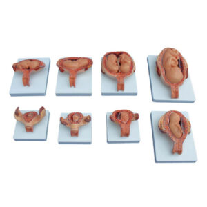 The Development Process for Fetus (Half-Size), XC-414A, ESMC, Xinch, China